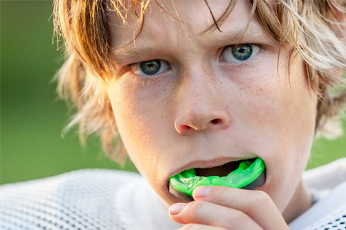Sports Mouthguards Keep You in the Game